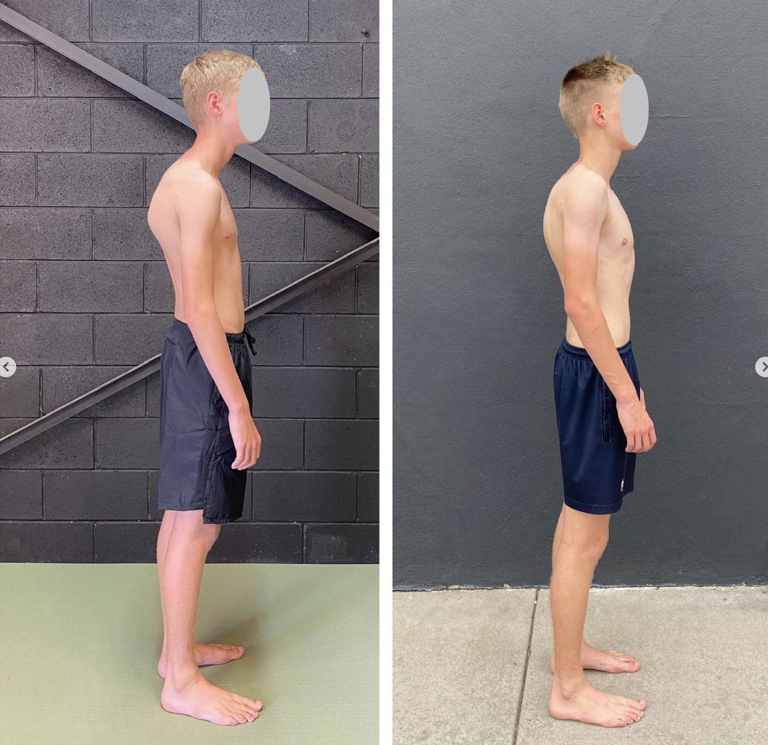 Why Functional Patterns is the Best Approach to Spinal Decompression
