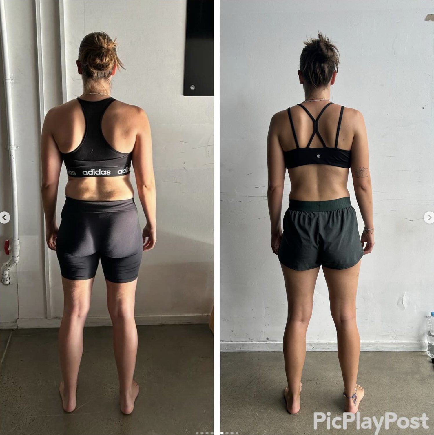 Back Decompression Exercises: What Actually Decompresses Your Spine? (Brisbane Guide)