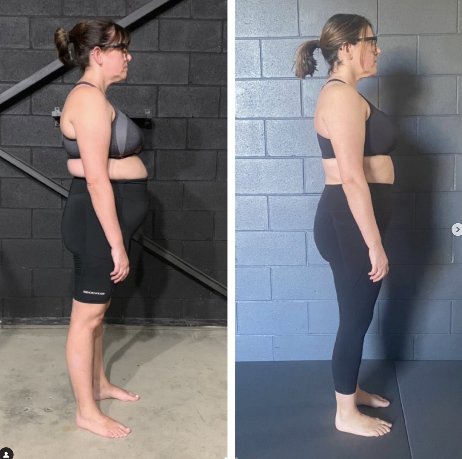 Back Decompression Exercises: What Actually Helps Your Spine