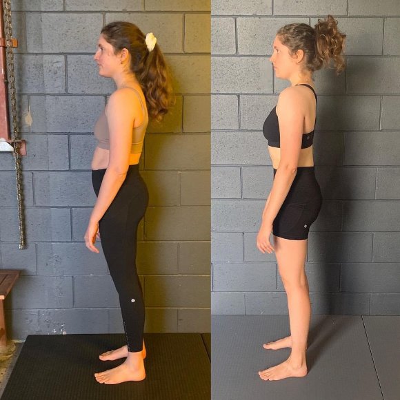 Exercises to Improve Your Posture (And Why Most Posture Exercises Fail)