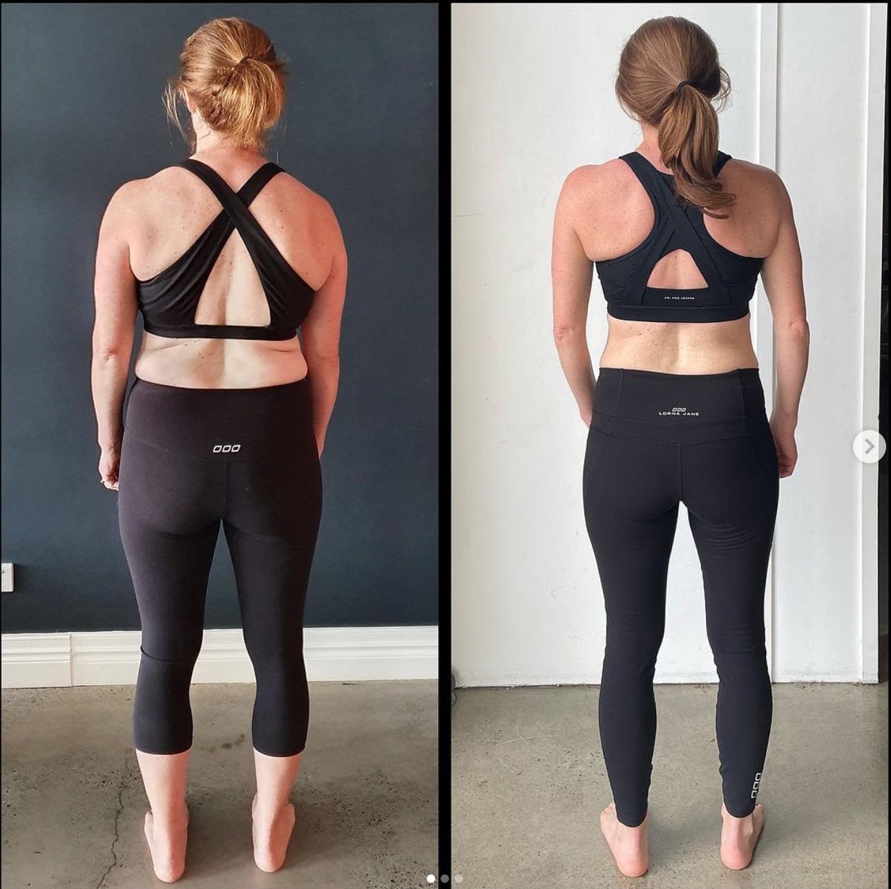 Fascia and Biomechanics - A Neuro-Endocrine Organ