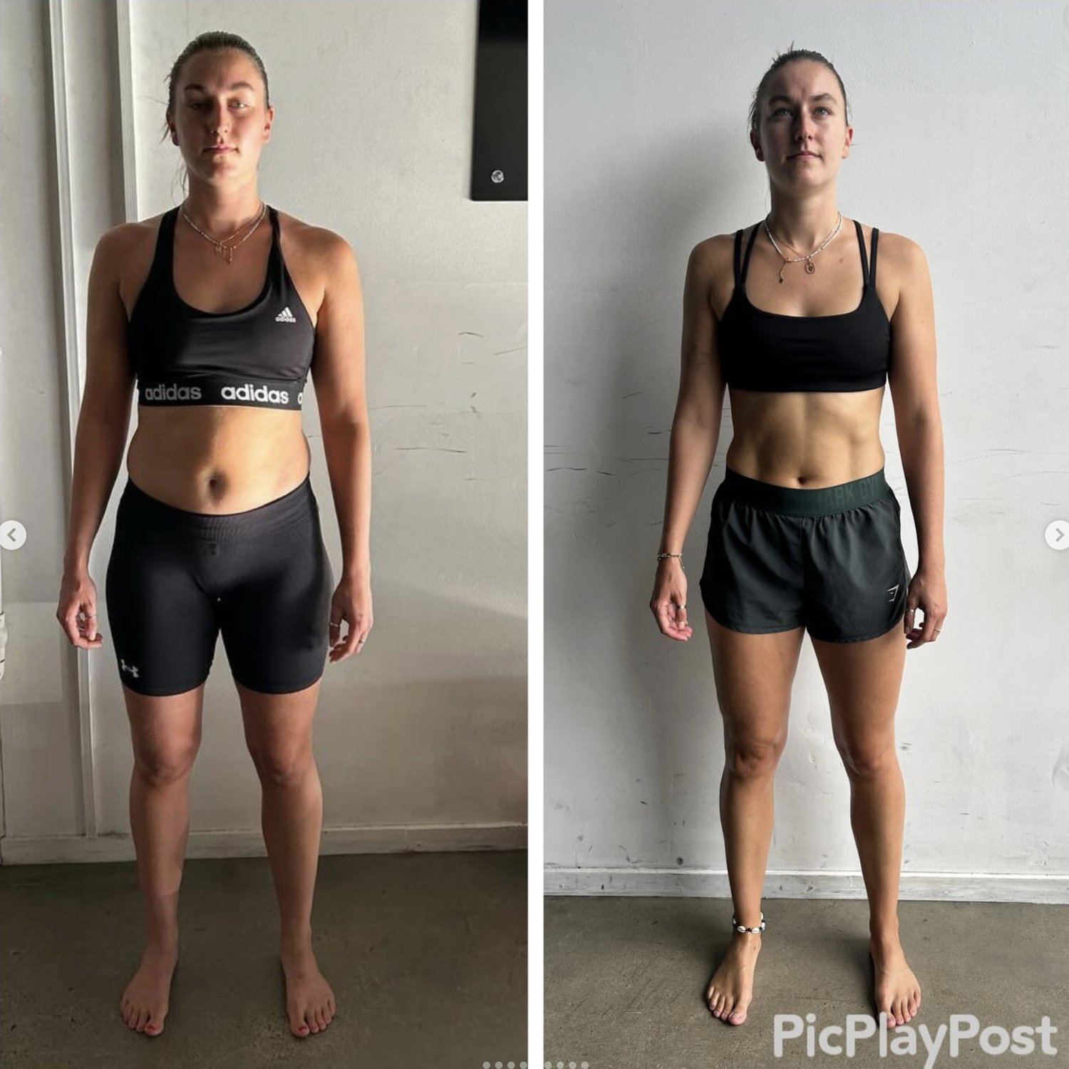 How to Fix Lower Back and Glute Pain (Brisbane Guide)
