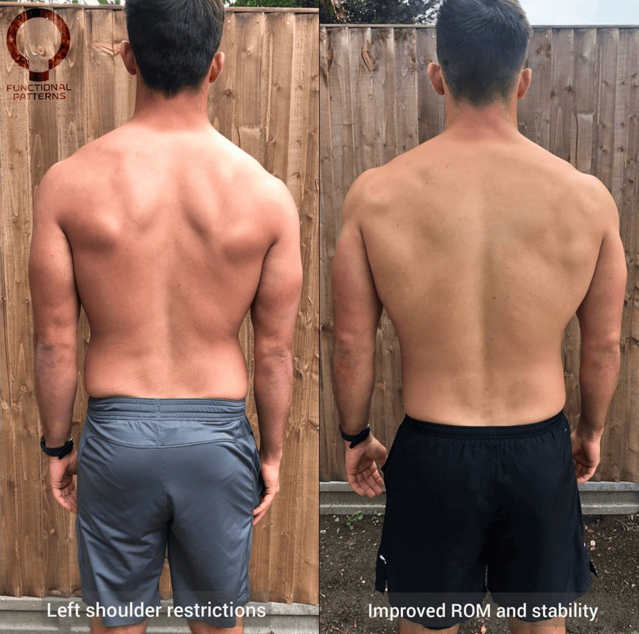 How to Relieve Upper Back Pain Fast Without Stretching.