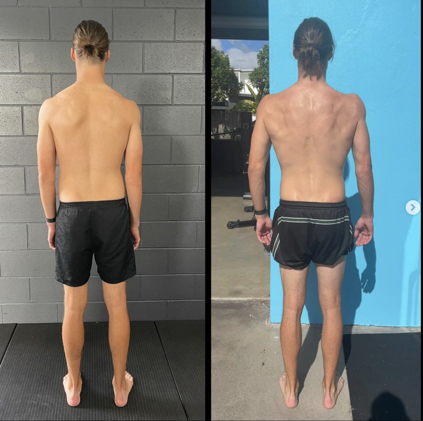 Bad Posture & Back Pain: Why the Problem Isn’t Your Back