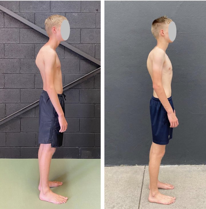 Bad Posture & Back Pain: Why the Problem Isn’t Your Back