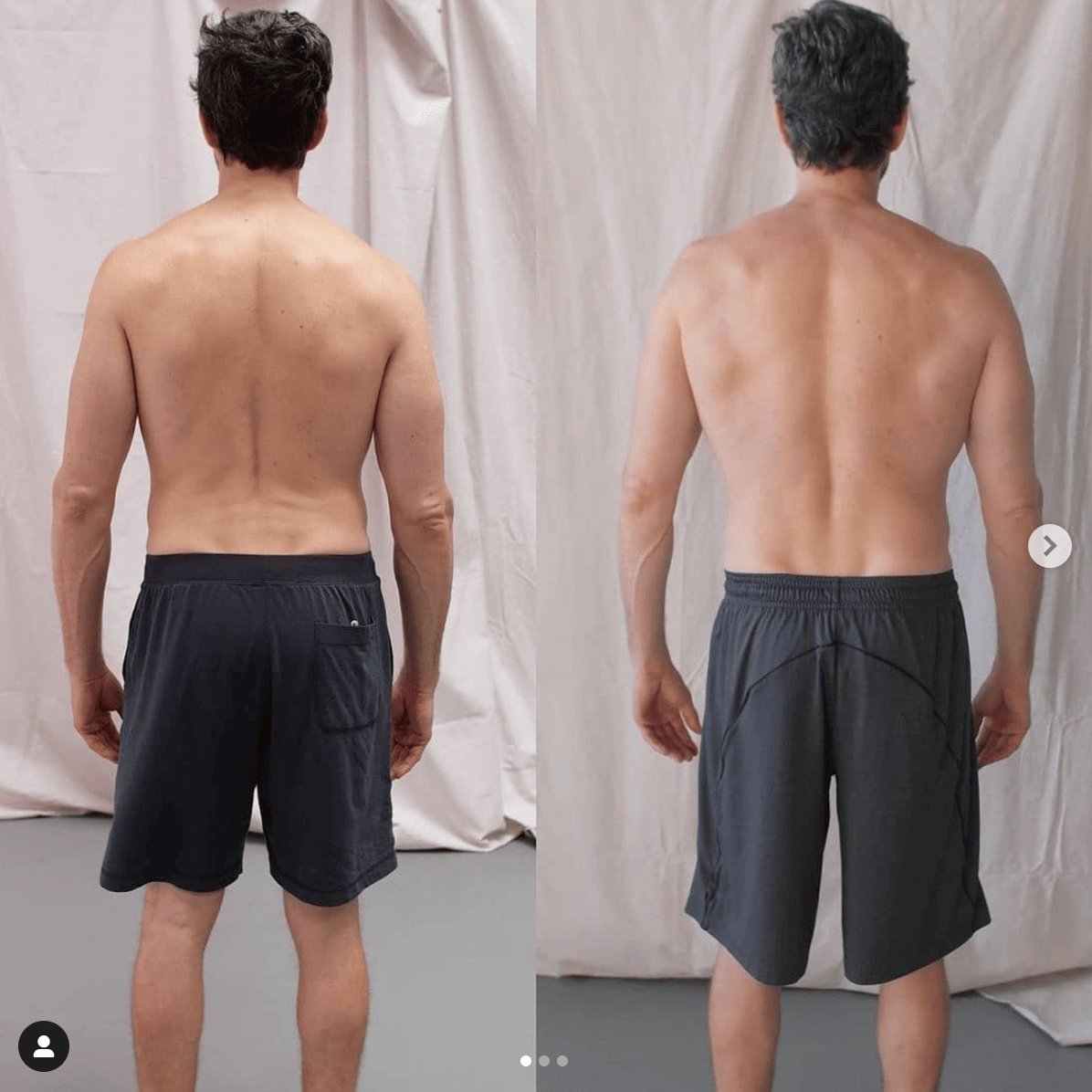 How to straighten your back — Read this if your lower back hurts when walking or standing