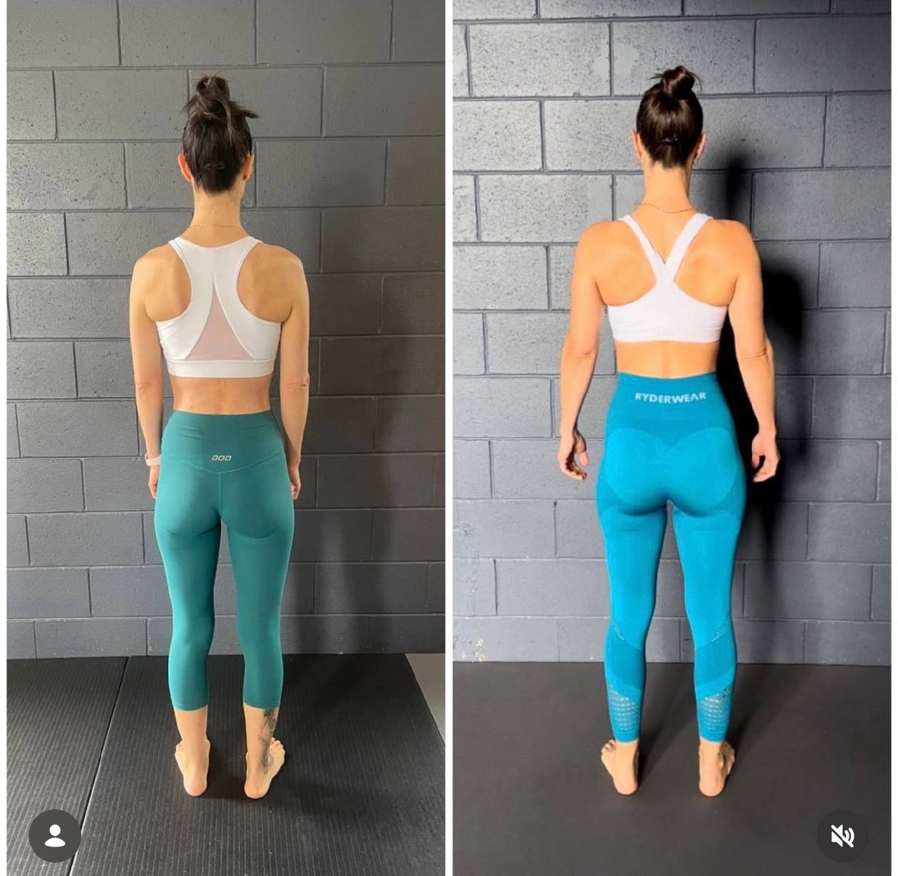 SCAPULAR WINGING: WHY EXERCISES ALONE WON’T FIX IT (AND WHAT WILL) — image 4