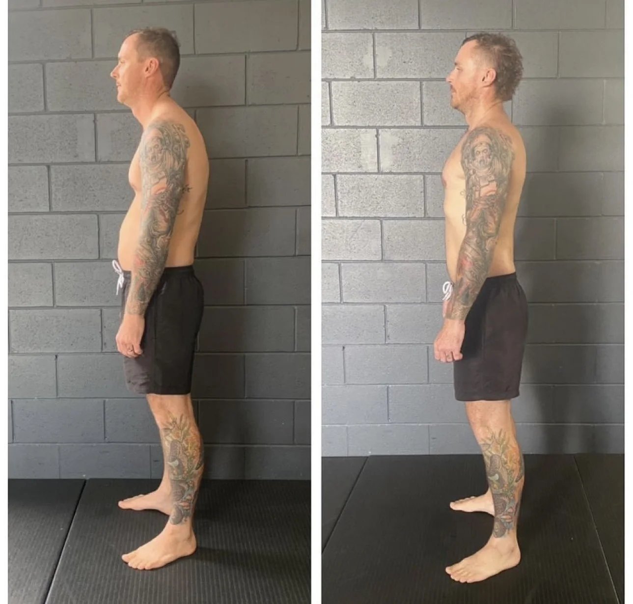 The 5 Best Things For Posture
