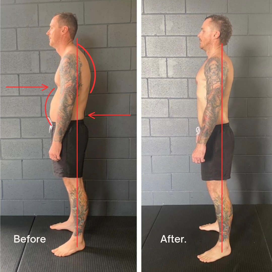 The 5 Worst Things For Posture