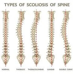 Thoracolumbar Spinal Curvature: What It Means, Why It Happens, and How to Improve Movement