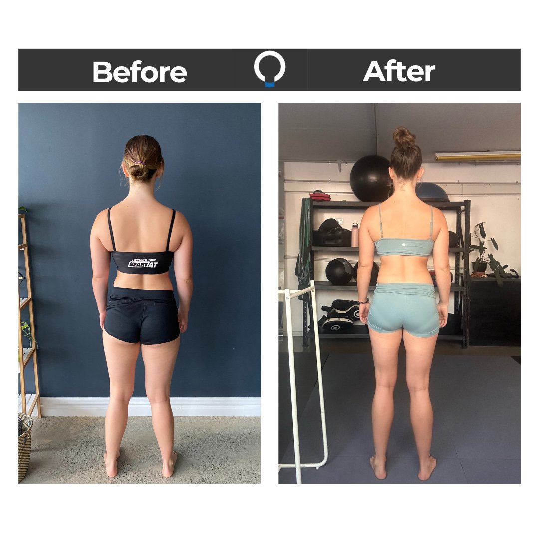Training To Strengthen Ehlers-Danlos Syndrome (EDS) Joints