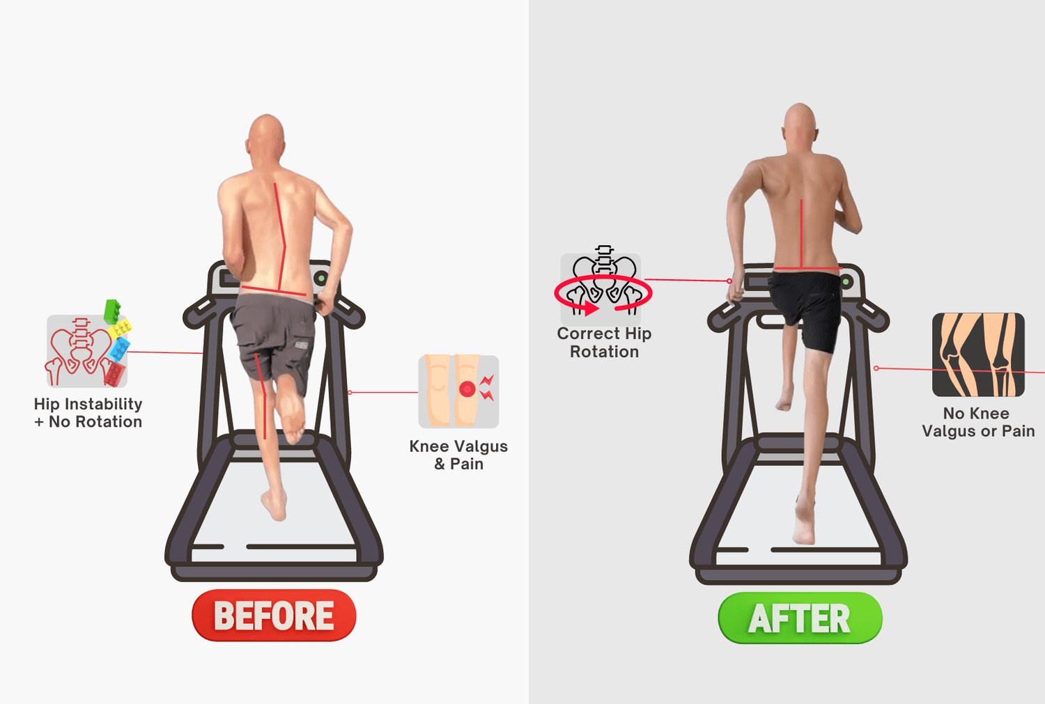 gait assessment for back pain brisbane