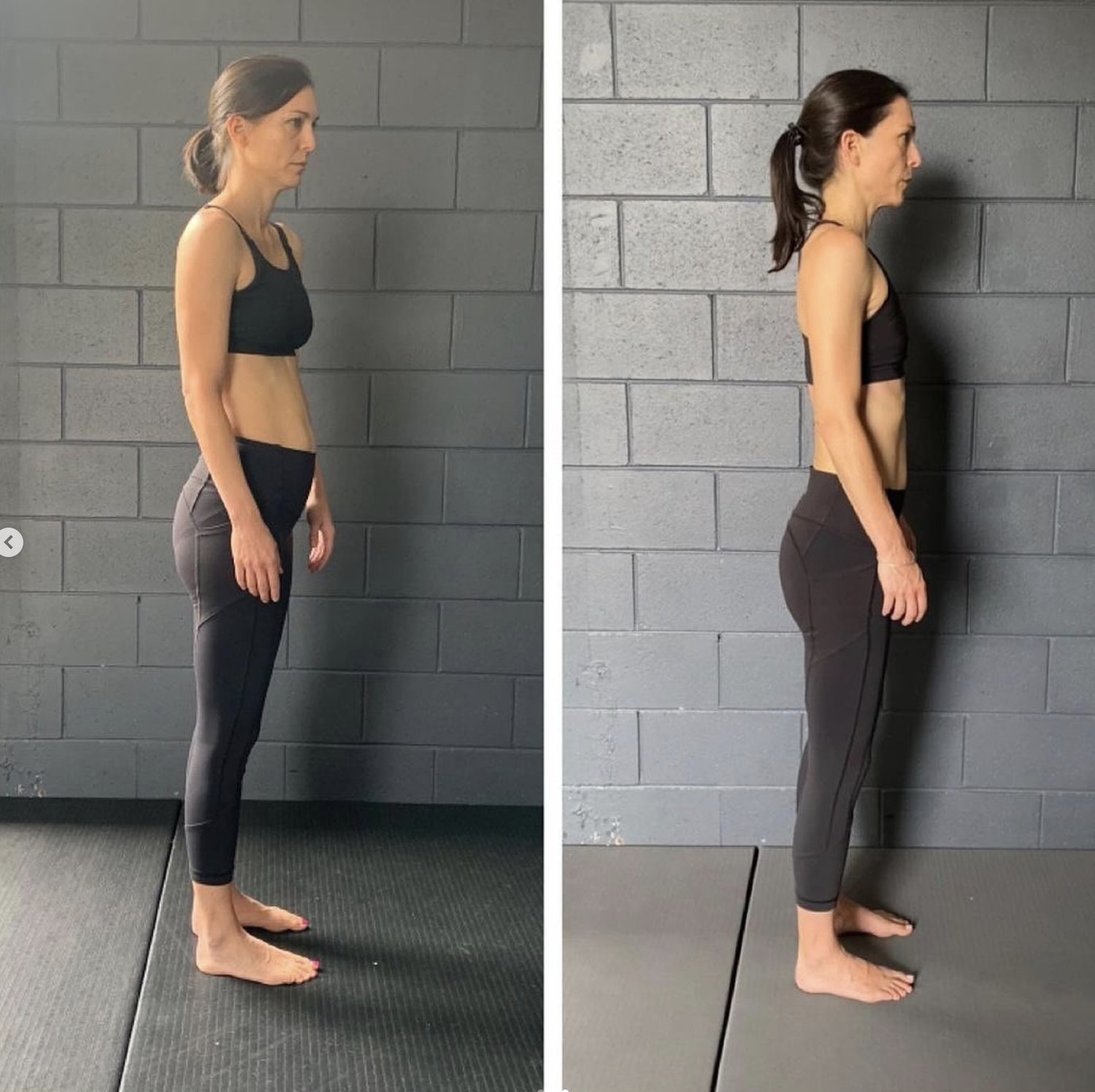 Understanding Poor Posture: A Comprehensive Guide