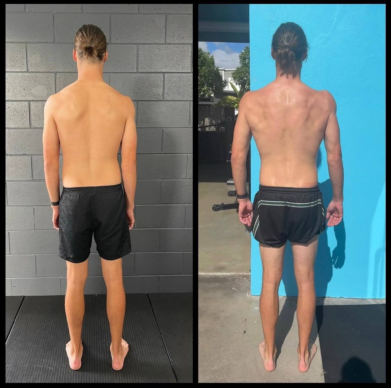Why Does My Back Pain Keep Coming Back? — image 3