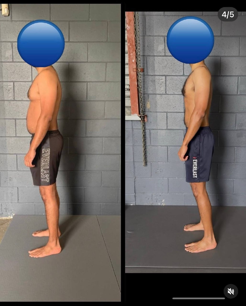Why Does My Back Pain Keep Coming Back? — image 4