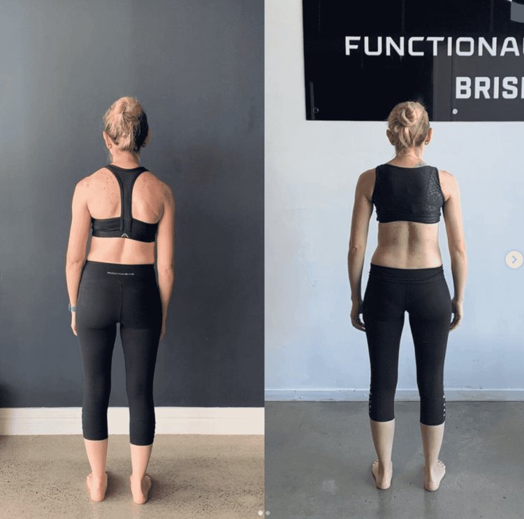 Why Tight Hips Keep Coming Back — Even After You Stretch