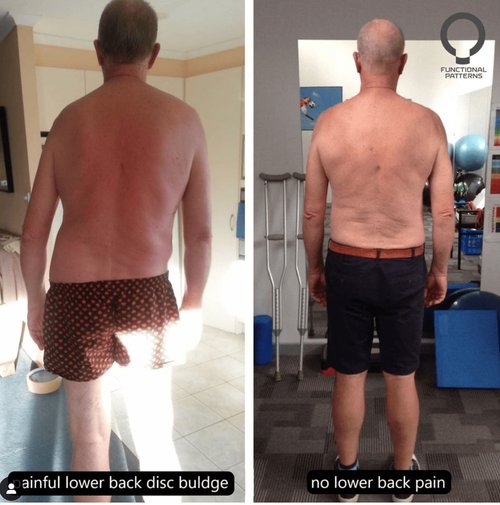 Why Your Pain Keeps Coming Back (And What to Do Instead)