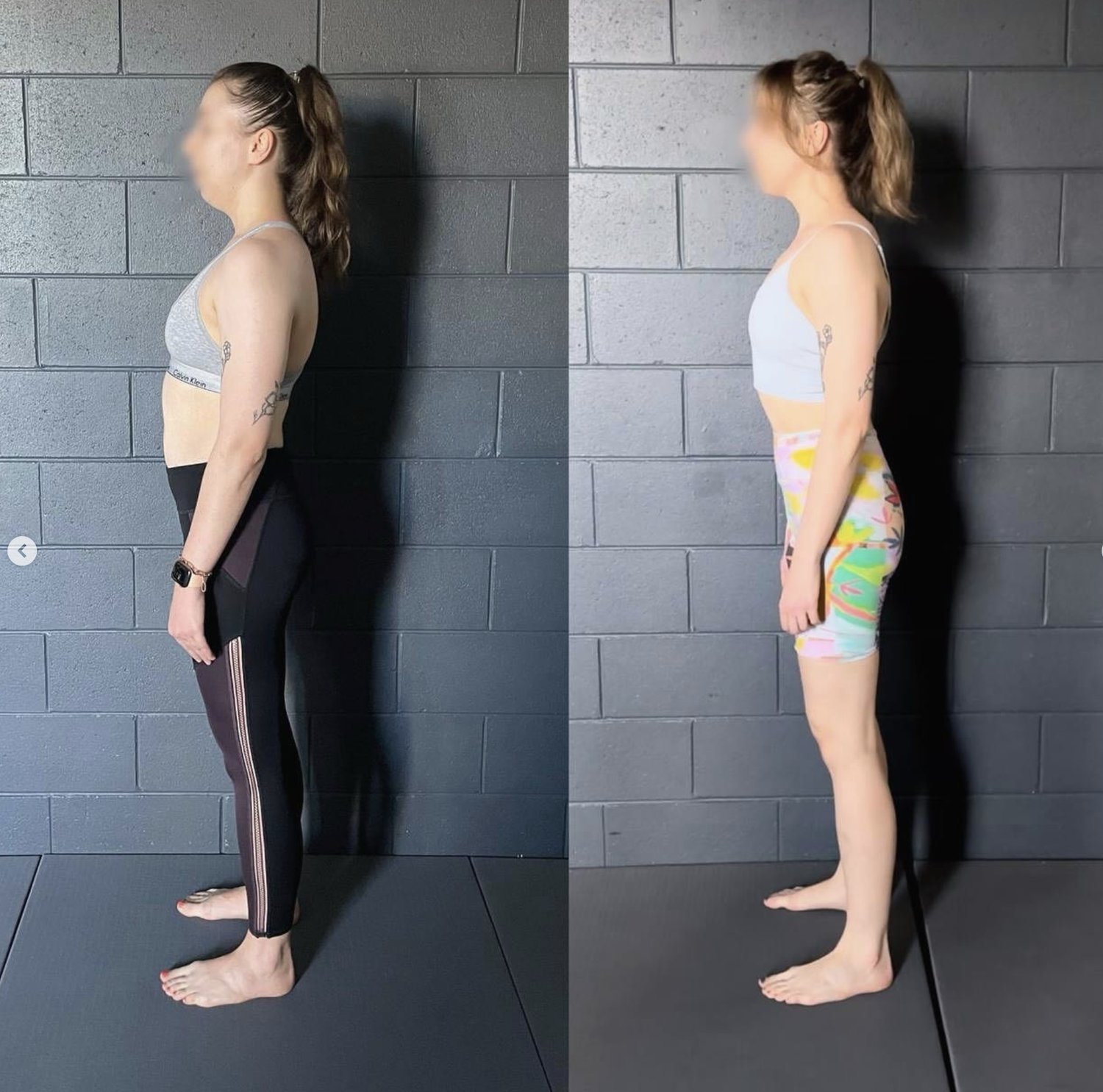 Why Your Rounded Shoulders Keep Coming Back – And What to Do Instead