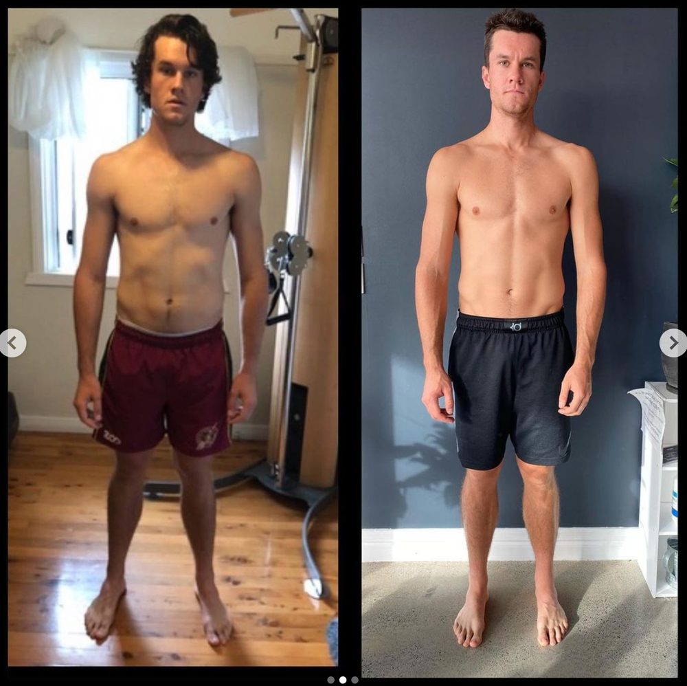2 years chronic groin and lumbar pain reversed — Functional Patterns Brisbane