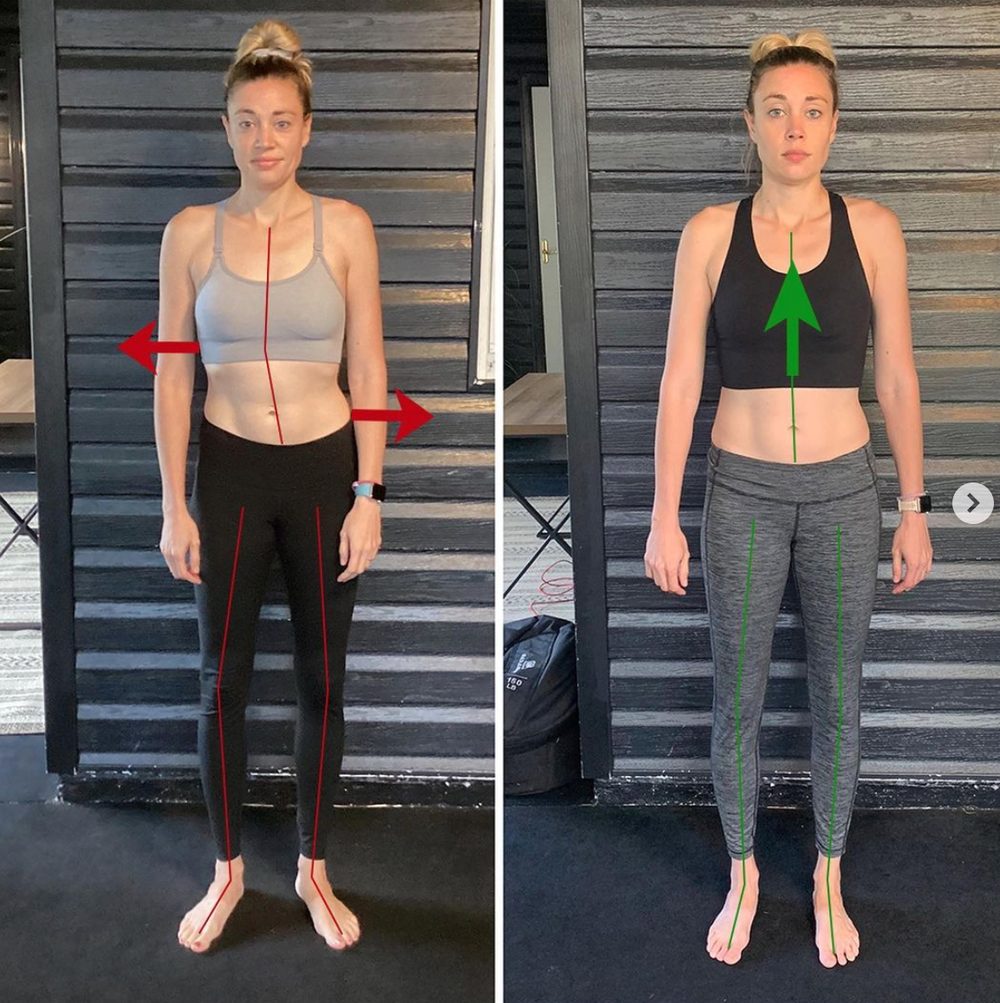 What Happens When People Focus On Fascia? — Functional Patterns Brisbane