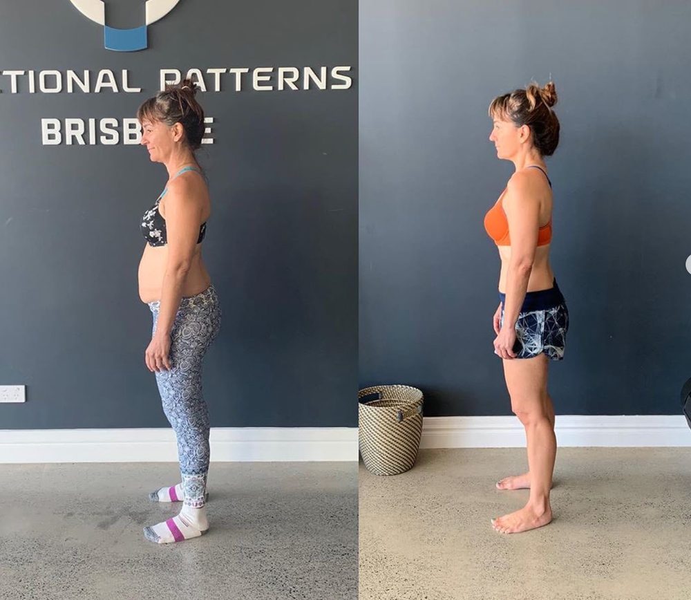 What Happens When People Focus On Fascia? — Functional Patterns Brisbane