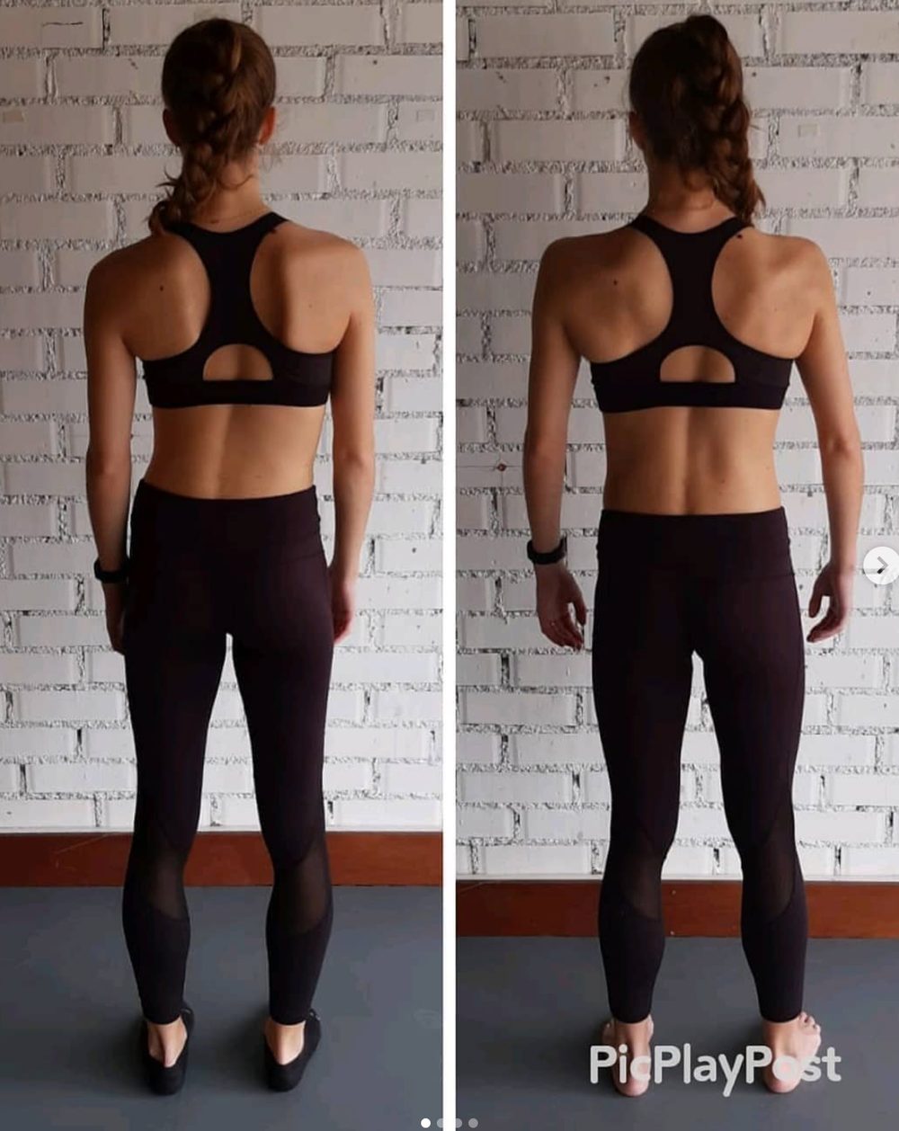 What Happens When People Focus On Fascia? — Functional Patterns Brisbane