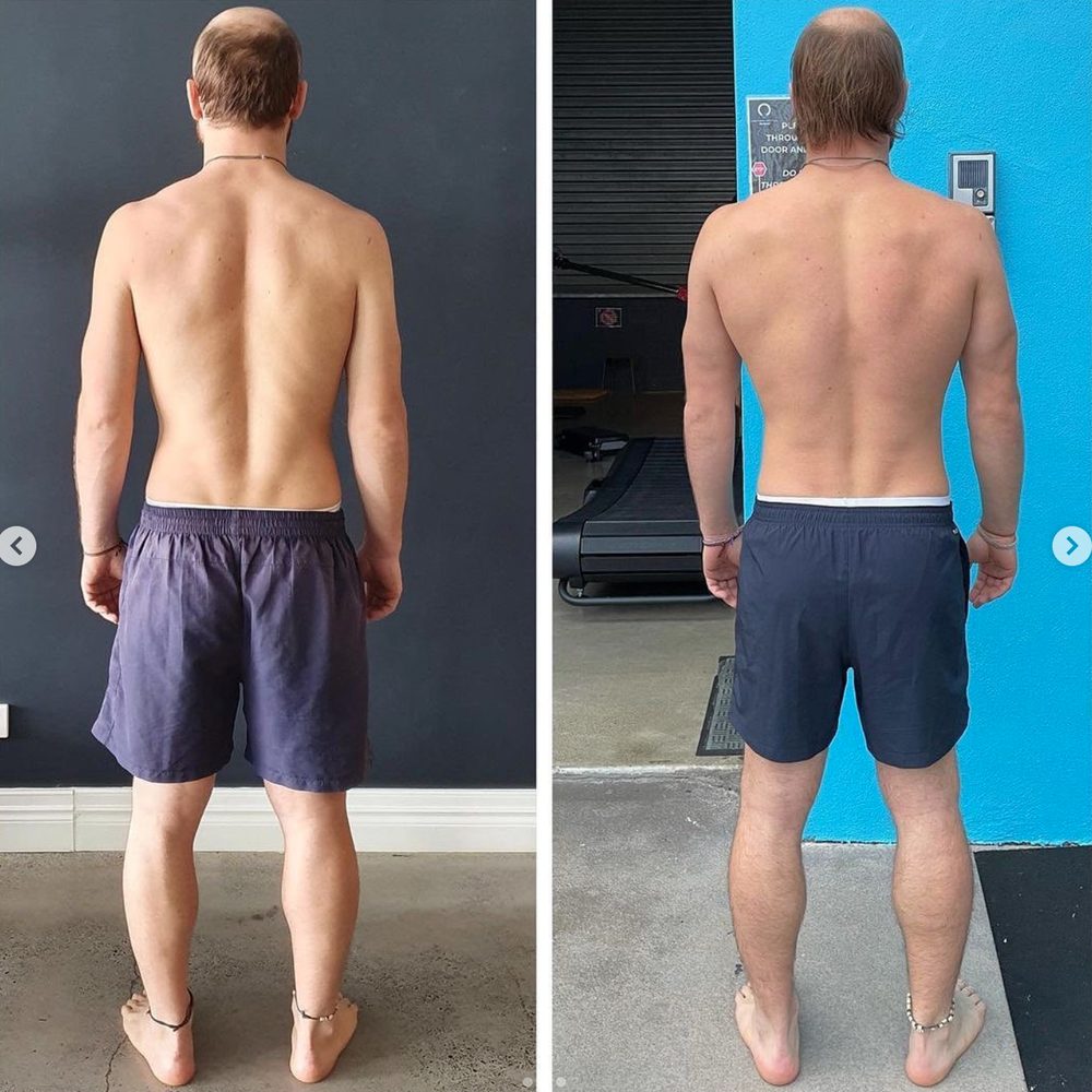 What Happens When People Focus On Fascia? — Functional Patterns Brisbane