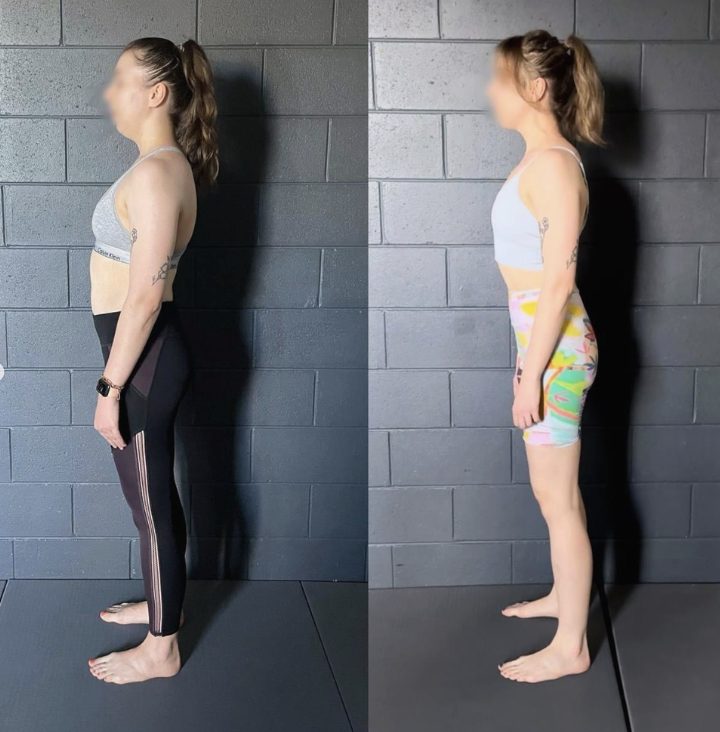 hunchback posture correction — Functional Patterns Brisbane