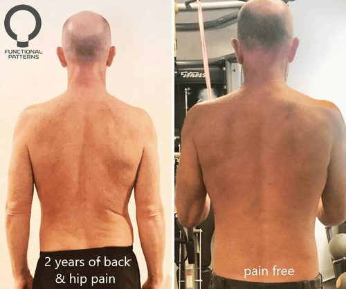how to fix scoliosis naturally — Functional Patterns Brisbane