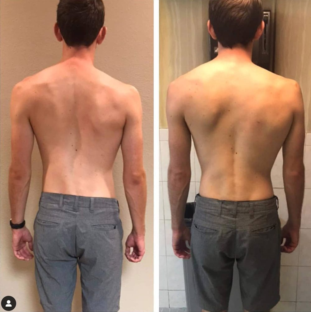 More Straightened Spines & Changed Lives — Functional Patterns Brisbane