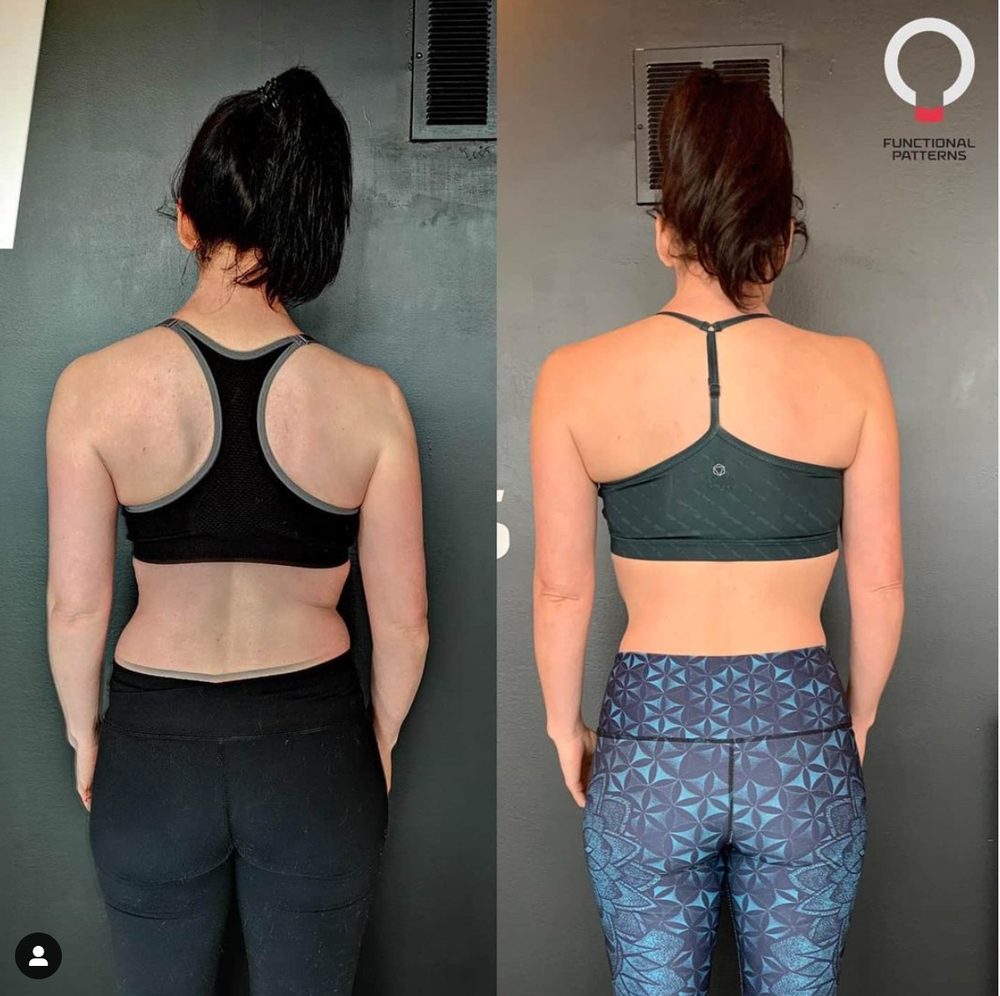More Straightened Spines & Changed Lives — Functional Patterns Brisbane