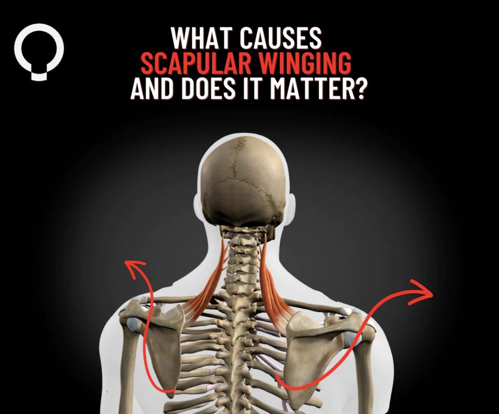 What causes scapula winging functional patterns — Functional Patterns Brisbane