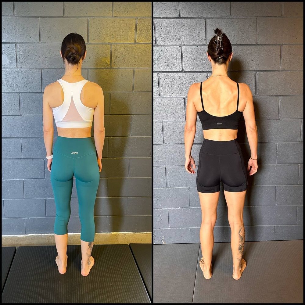 how to fix winged scapula — Functional Patterns Brisbane